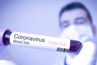Apa itu Penyakit coronavirus (COVID-19), dan Bagamaiana Mencegah Virus Corona